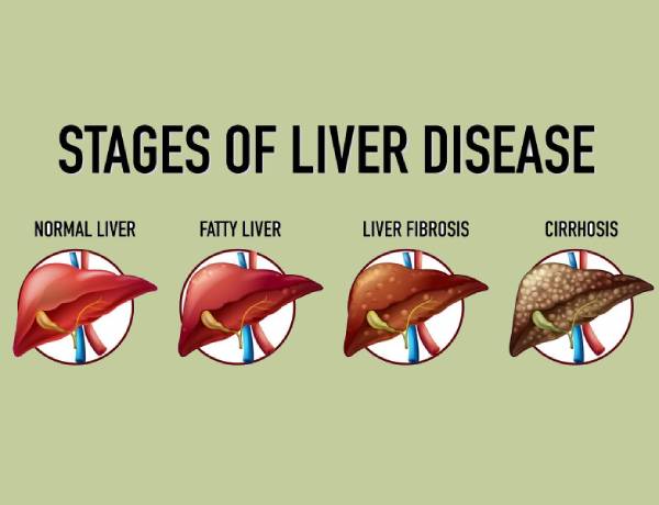 Liver Cirrhosis Treatment